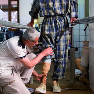 Protesi alla gamba per una vittima da mina